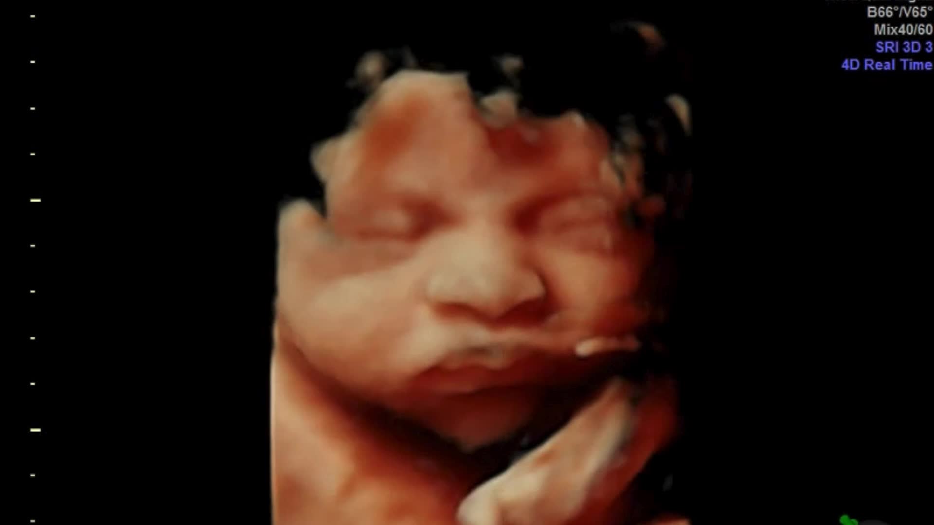 Real 3D ultrasound from Preggoland Mamas