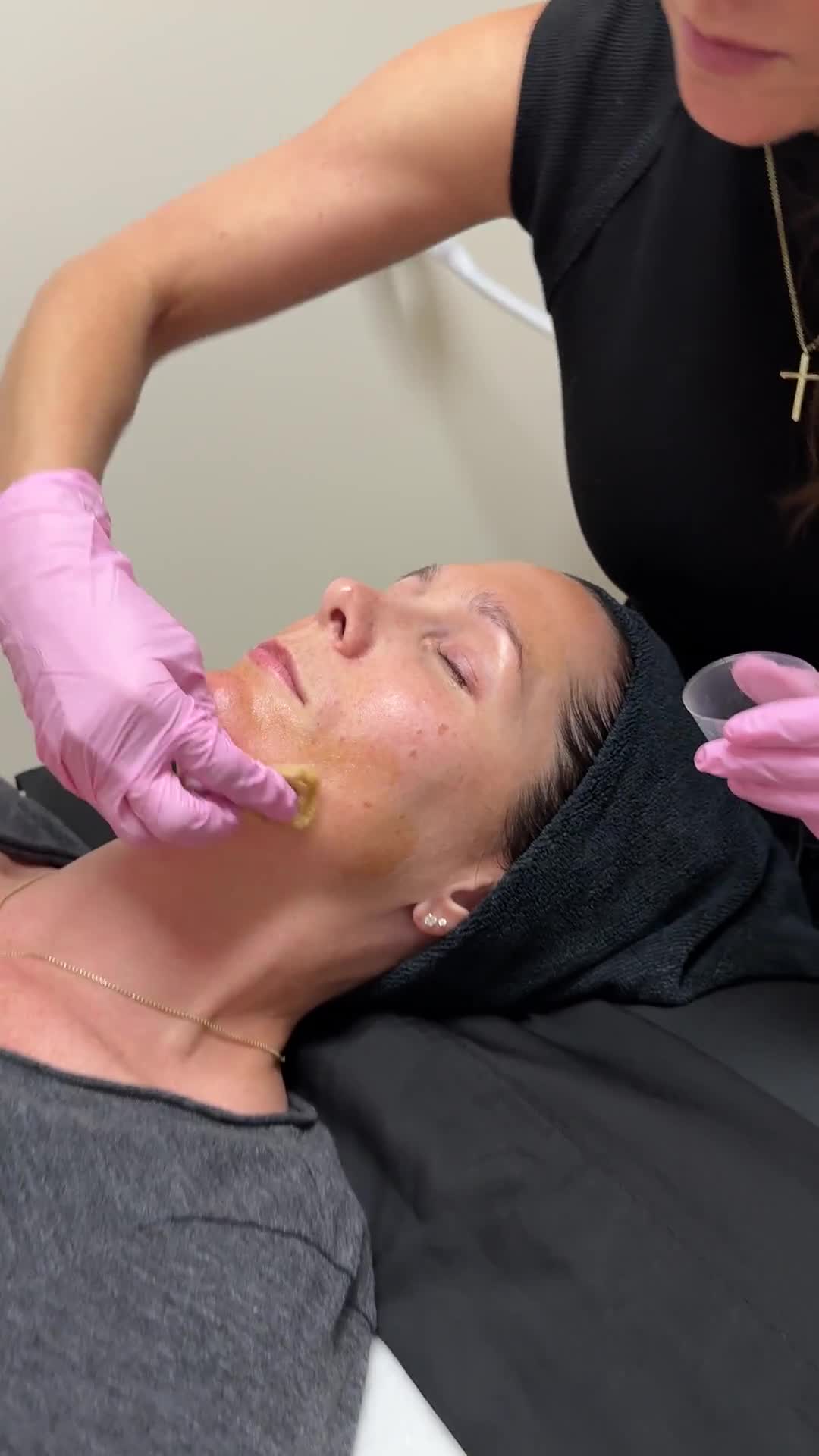 VI Peel — Smithville Med Spa