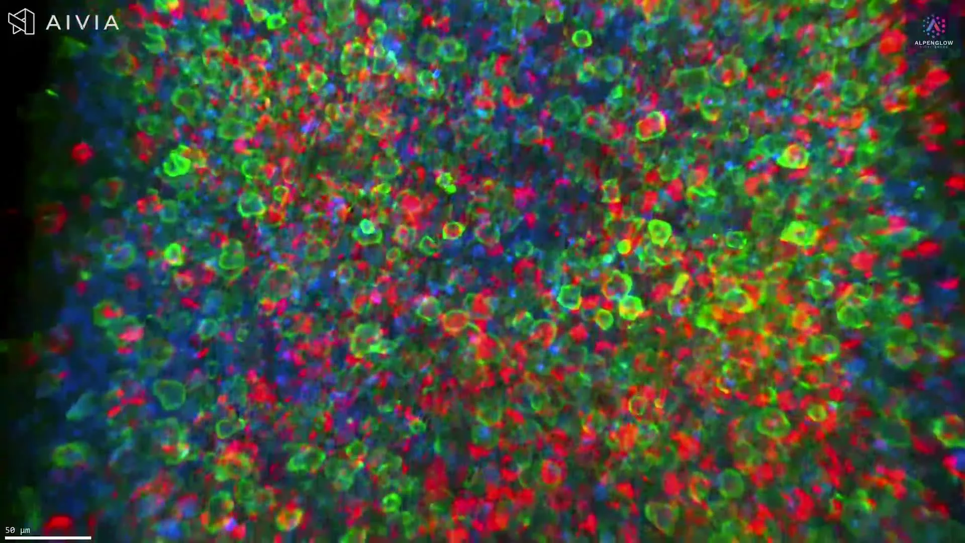 Immune organization in 3D. Intact mouse colorectal tumor