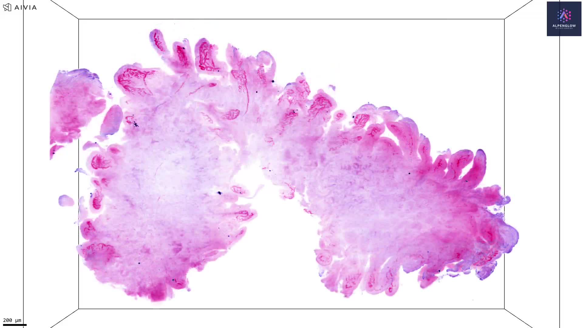 3D Imaging and Quantification of Human Duodenum Villi