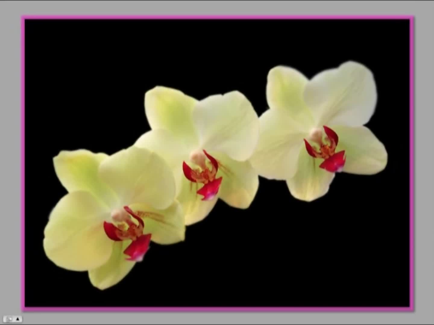 Vince Kokich Sr - 2012 - AAO Webinar - Missing Laterals