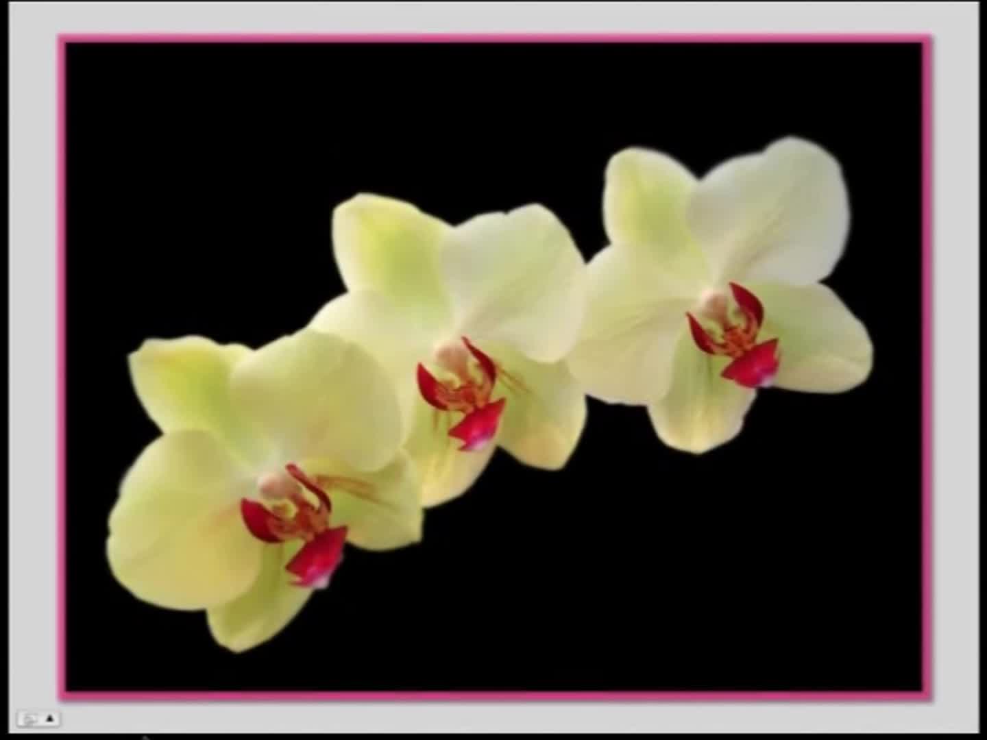 Vince Kokich Sr - 2011 - AAO Webinar - Ortho/Perio 1