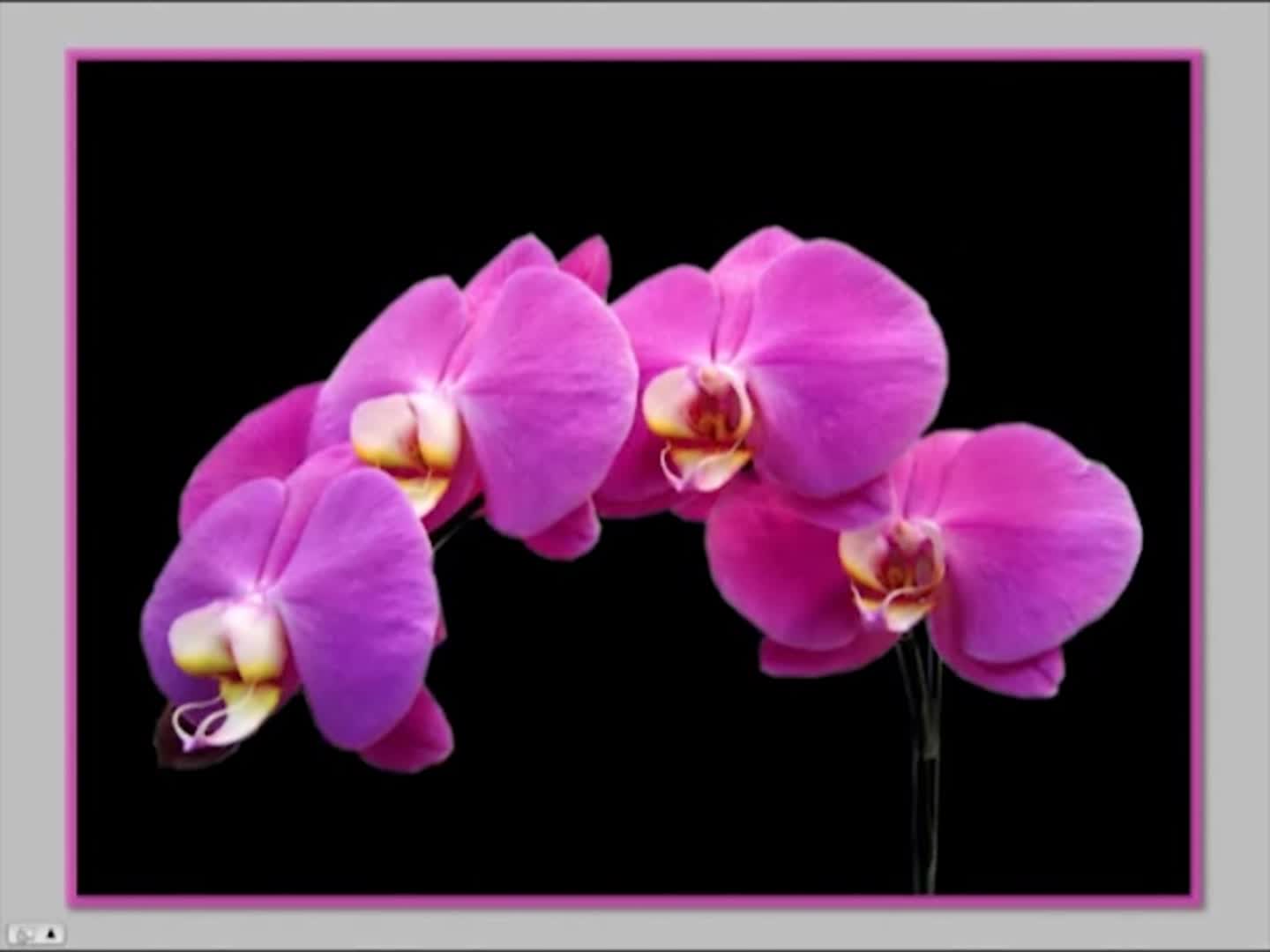 Vince Kokich Sr - 2012 - AAO Webinar - Altering Vertical Dimension