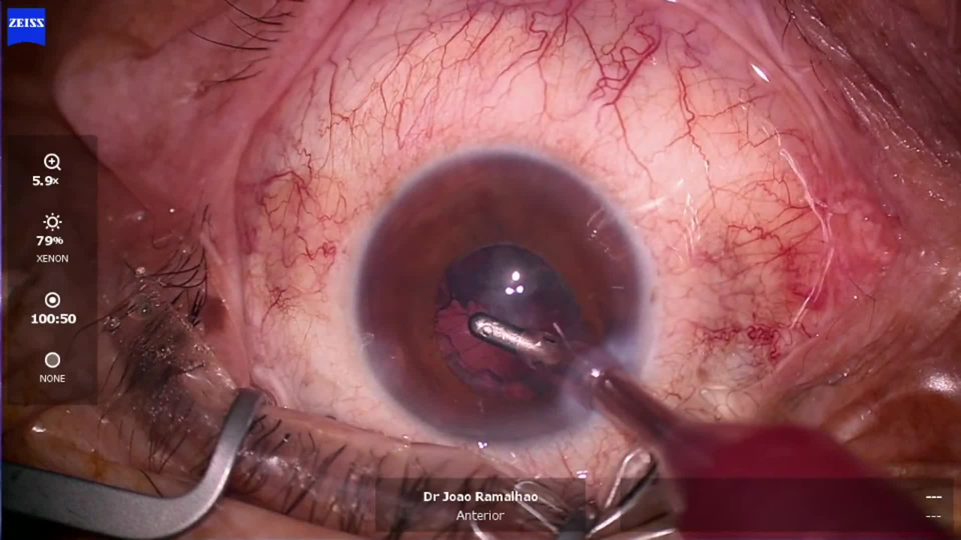Related Video Item Thumbnail