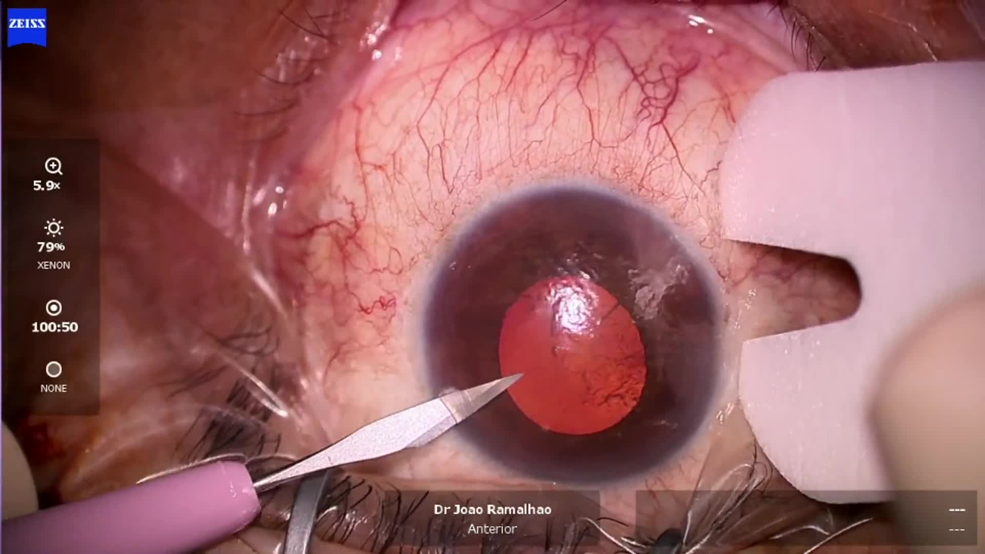Related Video Item Thumbnail