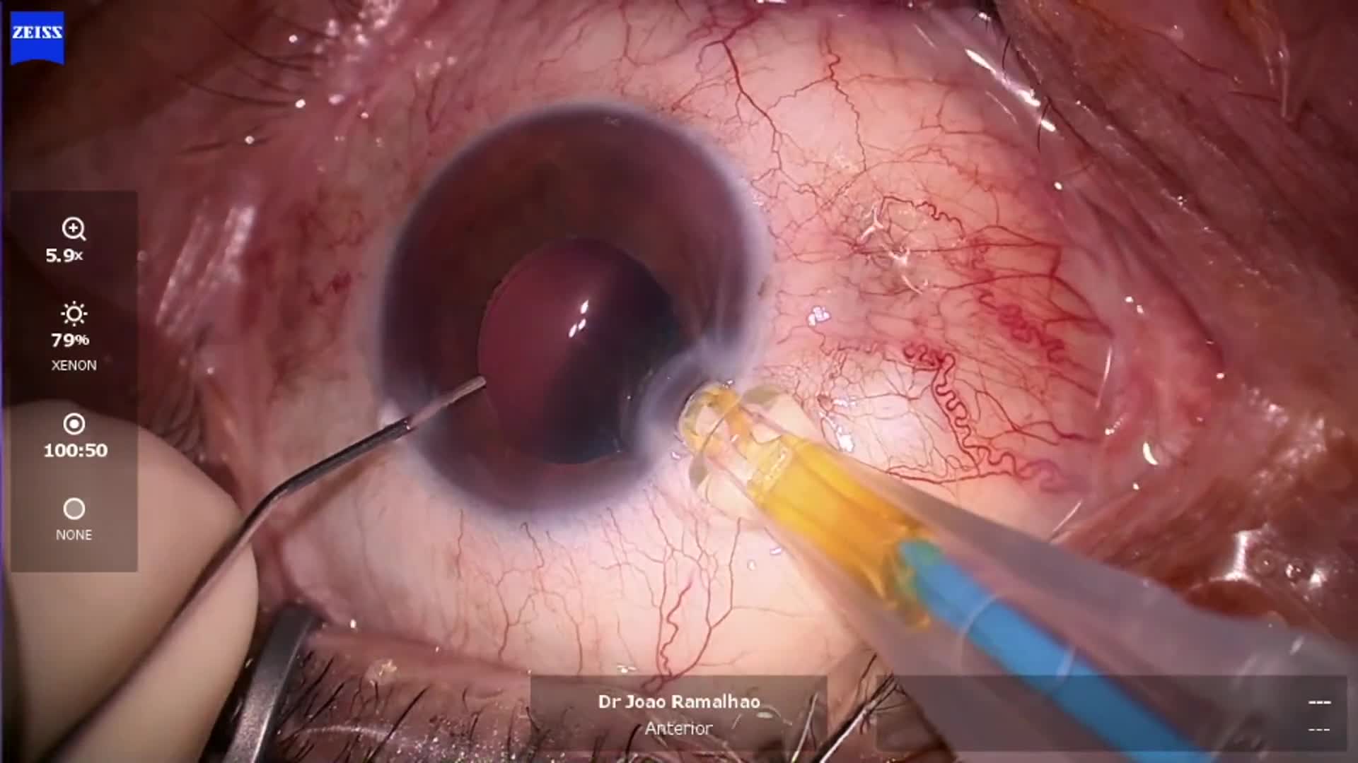 Related Video Item Thumbnail