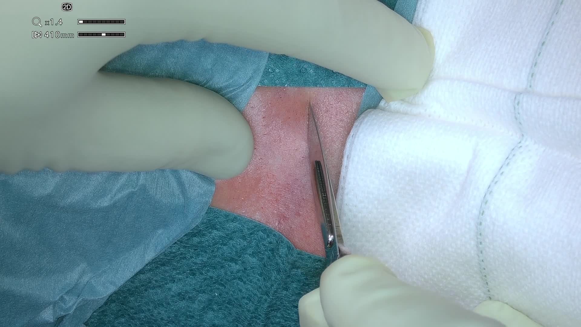 Related Video Item Thumbnail