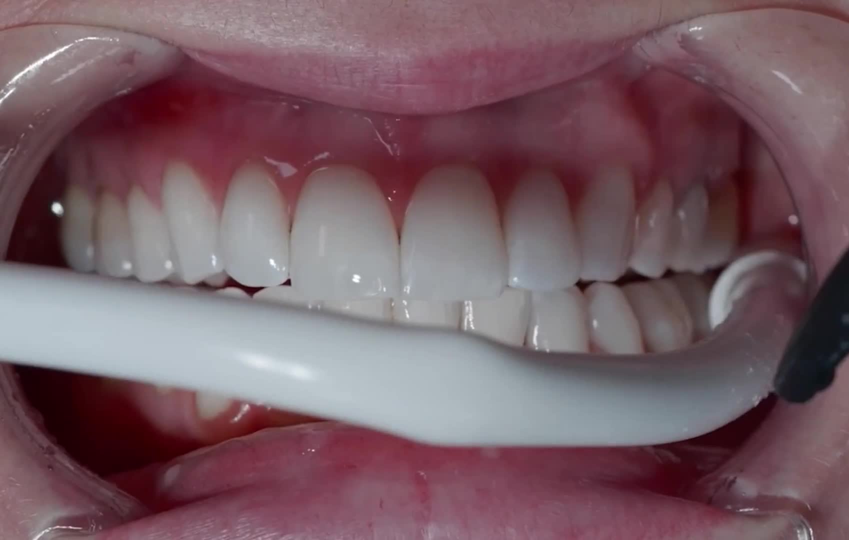 Related Video Item Thumbnail
