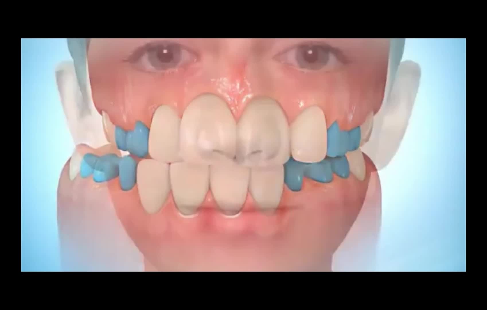 Related Video Item Thumbnail