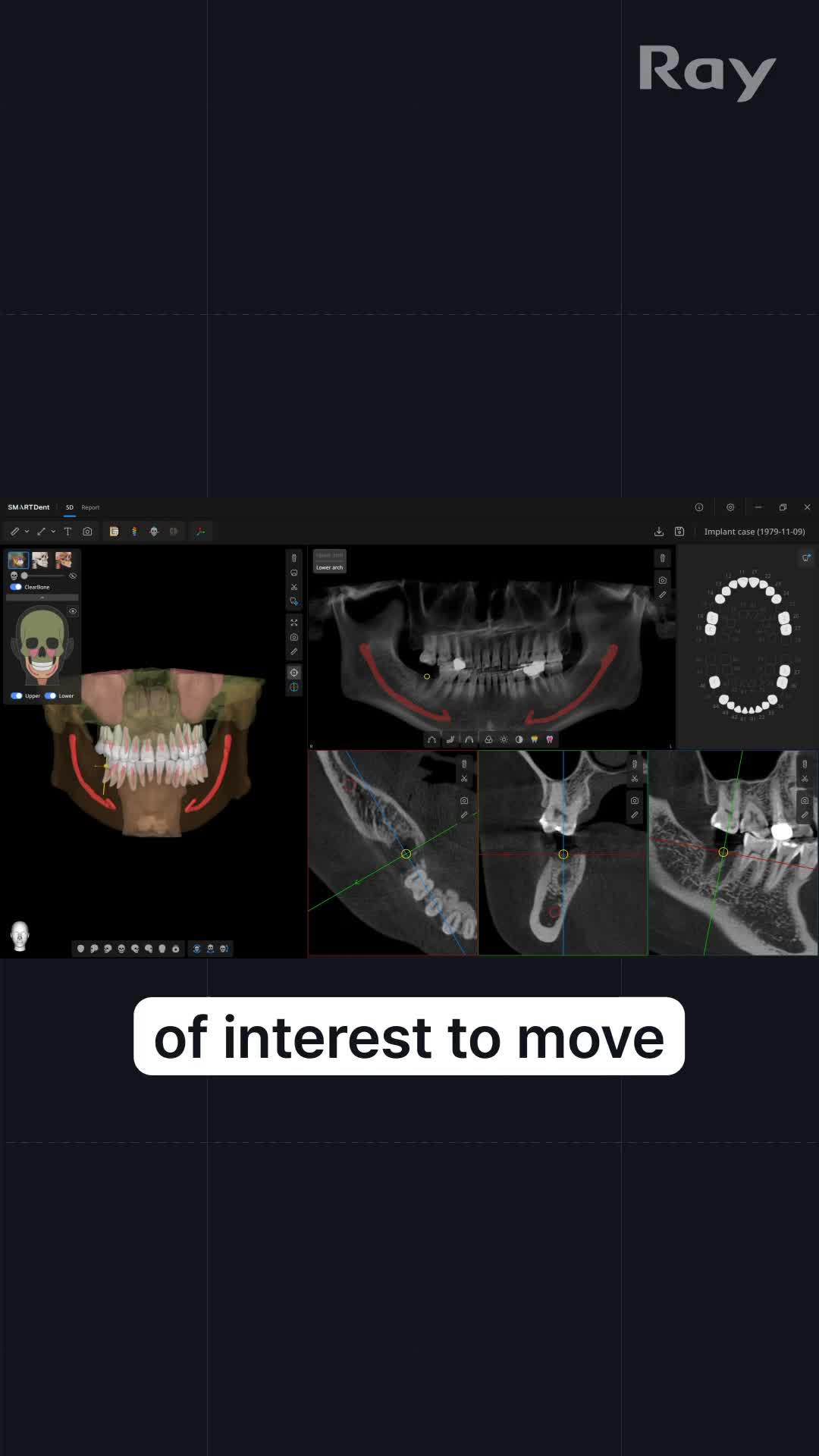 Related Video Item Thumbnail
