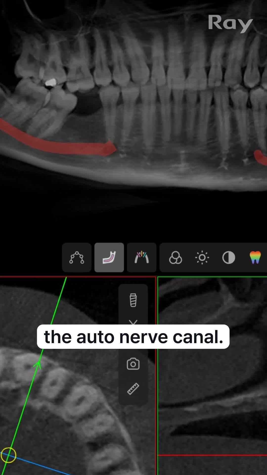 Related Video Item Thumbnail