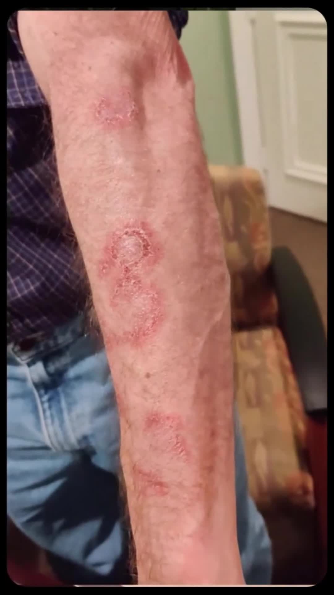Related Video Item Thumbnail
